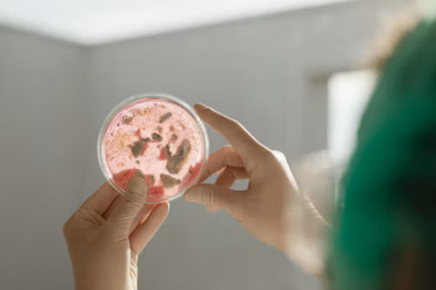 CDC, ABD